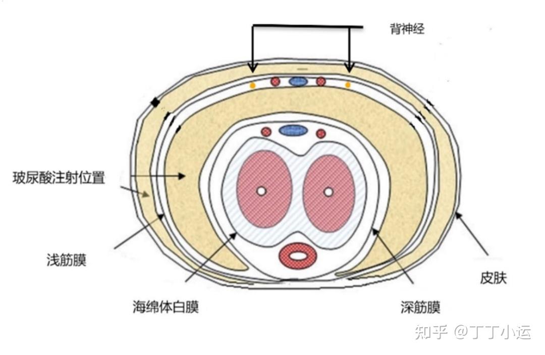 玻尿酸增大增粗图片