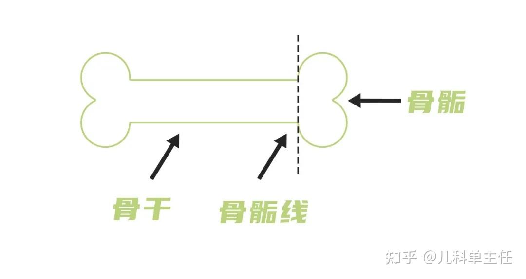 什麼是骨骺線?