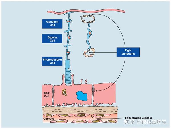 视网膜血管性疾病——概述 知乎 