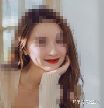 北京热门隆鼻医生测评 哪些擅长自然风 哪些擅长网红风 知乎