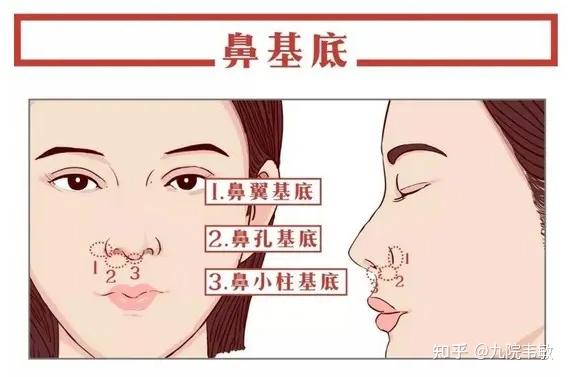 九院韦敏说,鼻基底凹陷与法令纹的关系 - 知乎