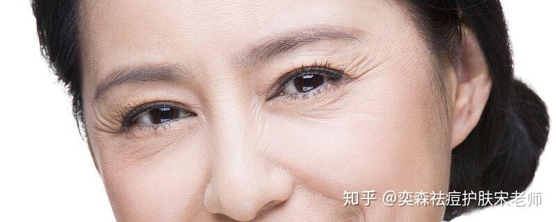 脸部的这些纹，你真的知道它们的来历吗？ - 知乎