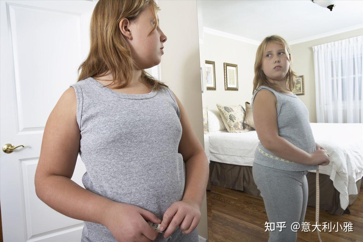 水肿型肥胖水肿型肥胖的人通常表现为下半身偏胖,特别是臀,腿会显得