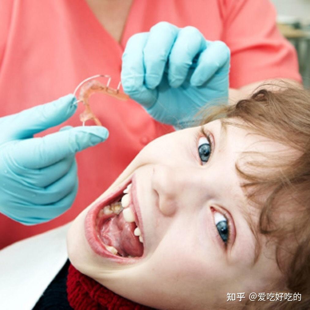 儿童也需要假牙吗