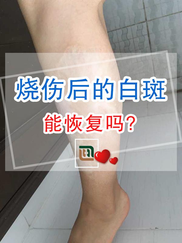 v2-ccf29b3ed586b043a4970347f2c2b90e_1440w.jpg?source=172ae18b