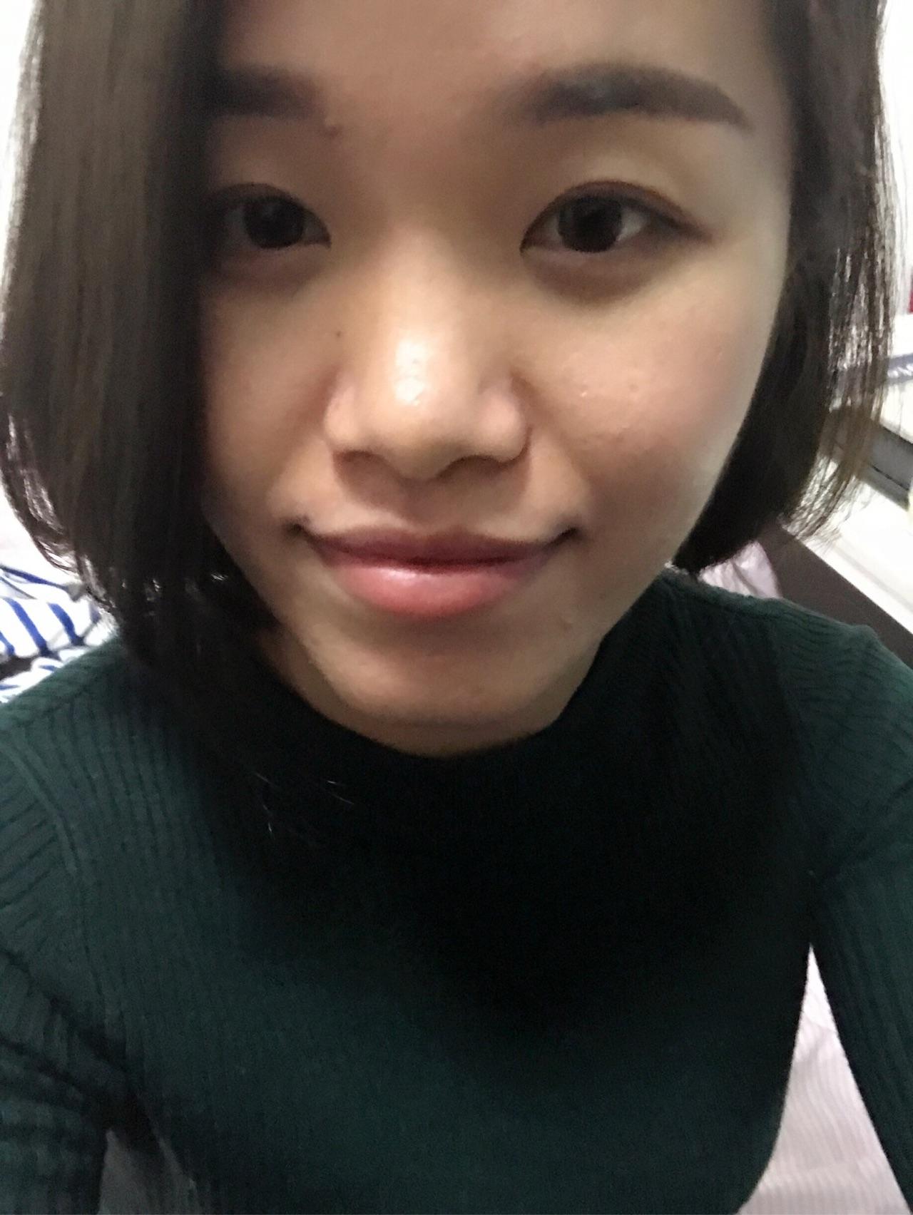 牙齿矫正是怎么样的感受,矫正过程中和矫正后