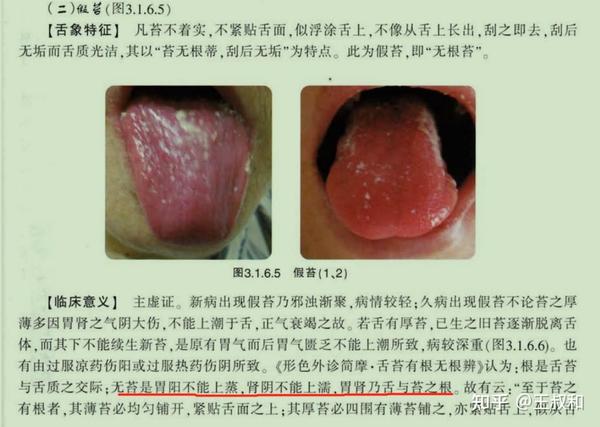 王叔和一文教会你中医舌诊基础知识 - 知乎