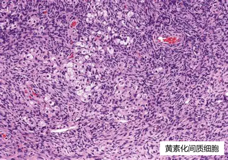 卵巢正常组织学及免疫组化【病理医生进阶专题】 - 知乎