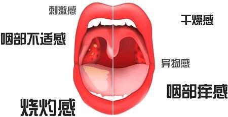 首大石萍 单侧扁桃体肿大不能大意 知乎