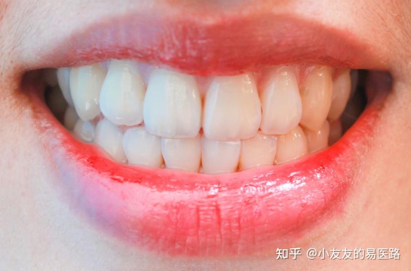 牙齿健康,离不开中药刷牙