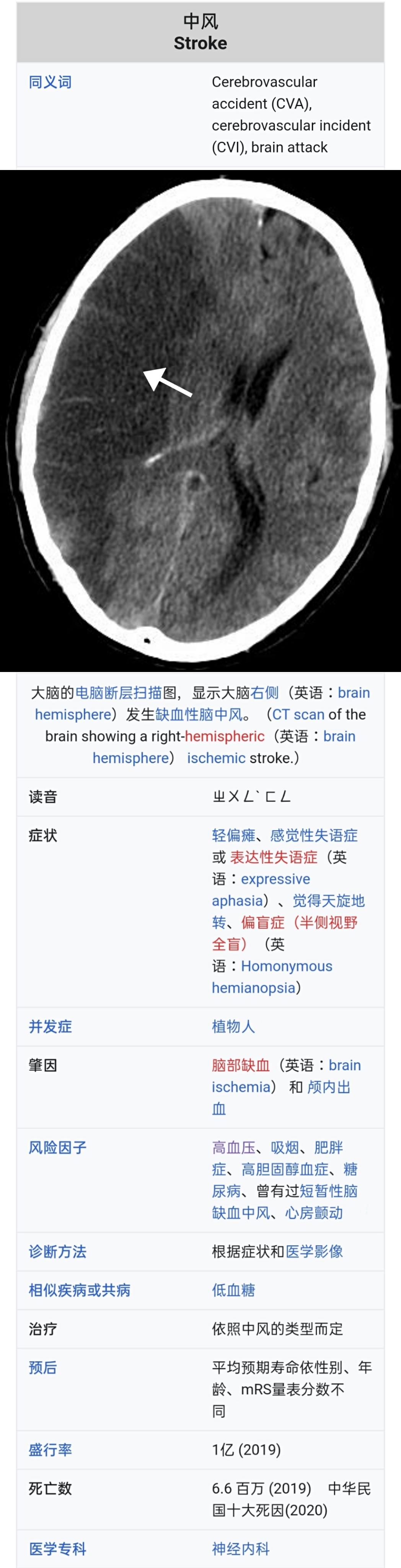 高血压—冠状动脉疾病/中风/心脏衰竭/心房颤动/周边动脉阻塞/视力受损/慢性肾脏病/痴呆症/妊娠毒血症- 知乎