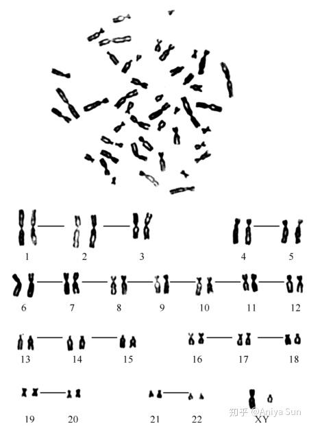 表1 人类非显带染色体的分组及各组形态特征核型的描述包括两部分内容