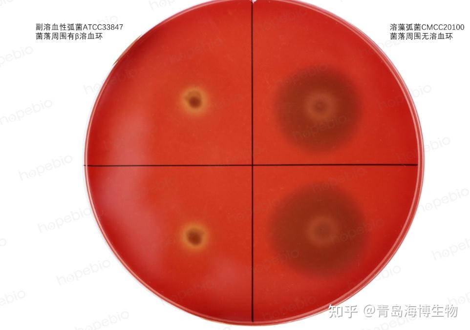 细菌溶血试验原理及现象 - 知乎