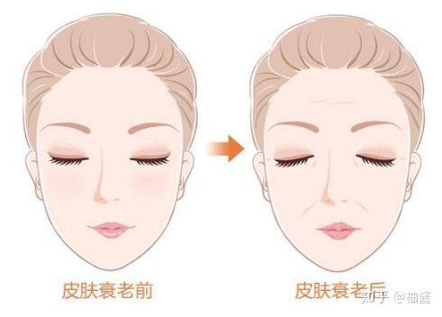 衰老性肌肤