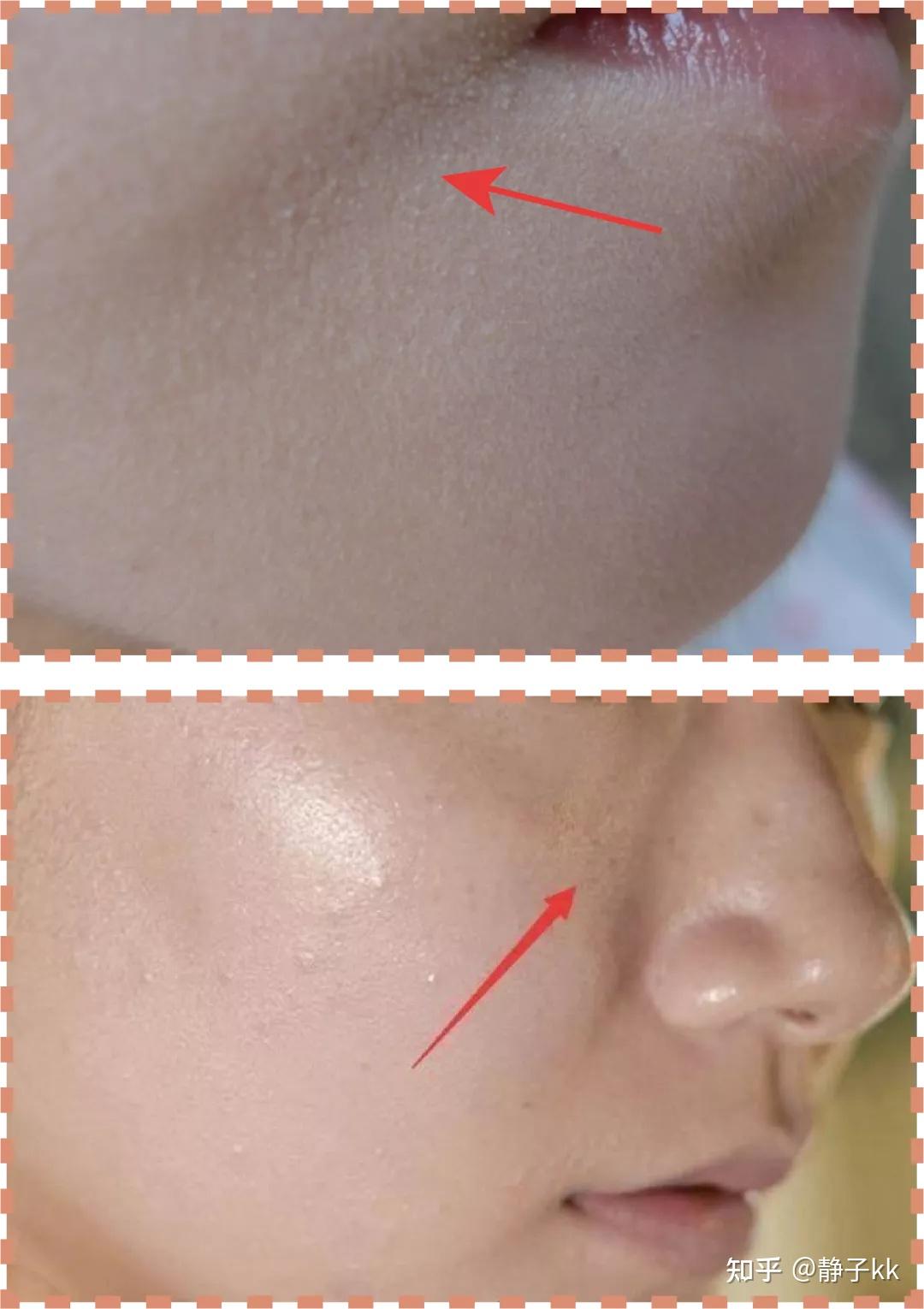 化妆卡粉严重是皮肤缺水吗