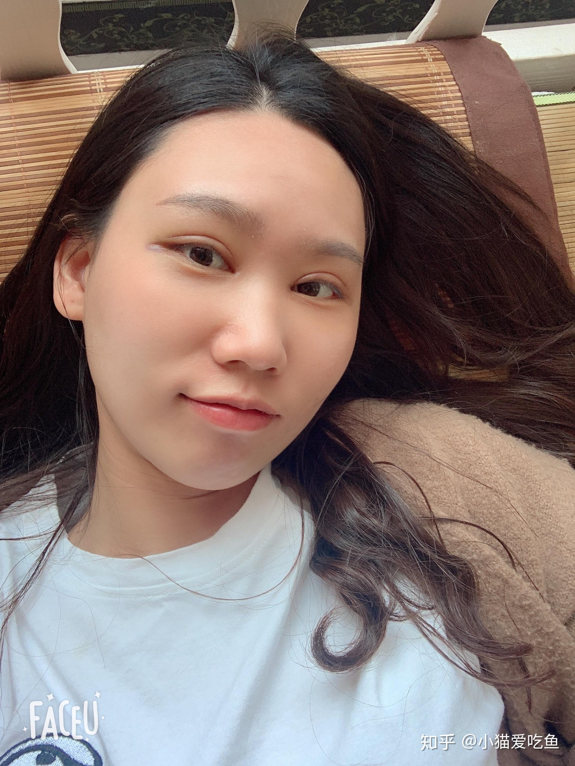 全切线小平行眼