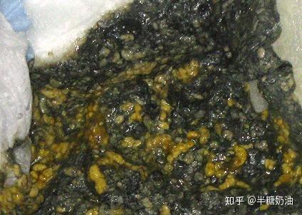 图解宝宝便便 - 知乎