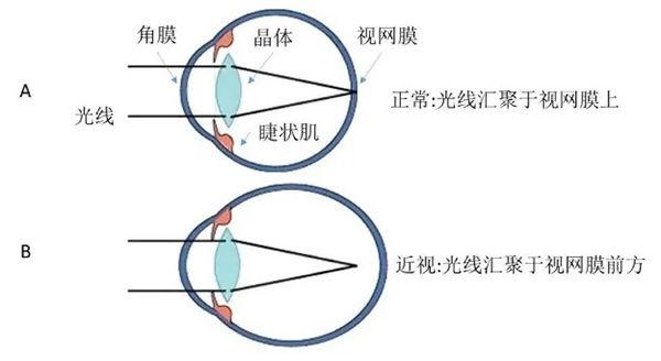 OK镜到底是啥？ - 知乎