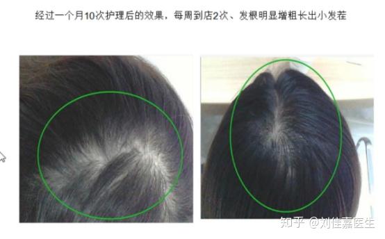 v2-ce9dff397dcde15dc88525aec87b447a_r.jpg