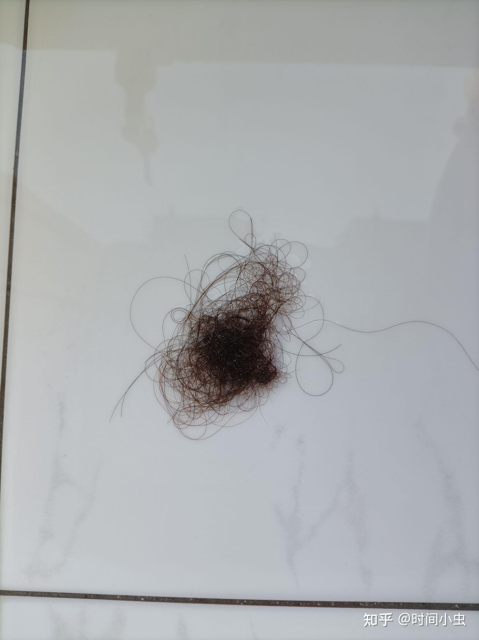 男生考研掉头发怎么办