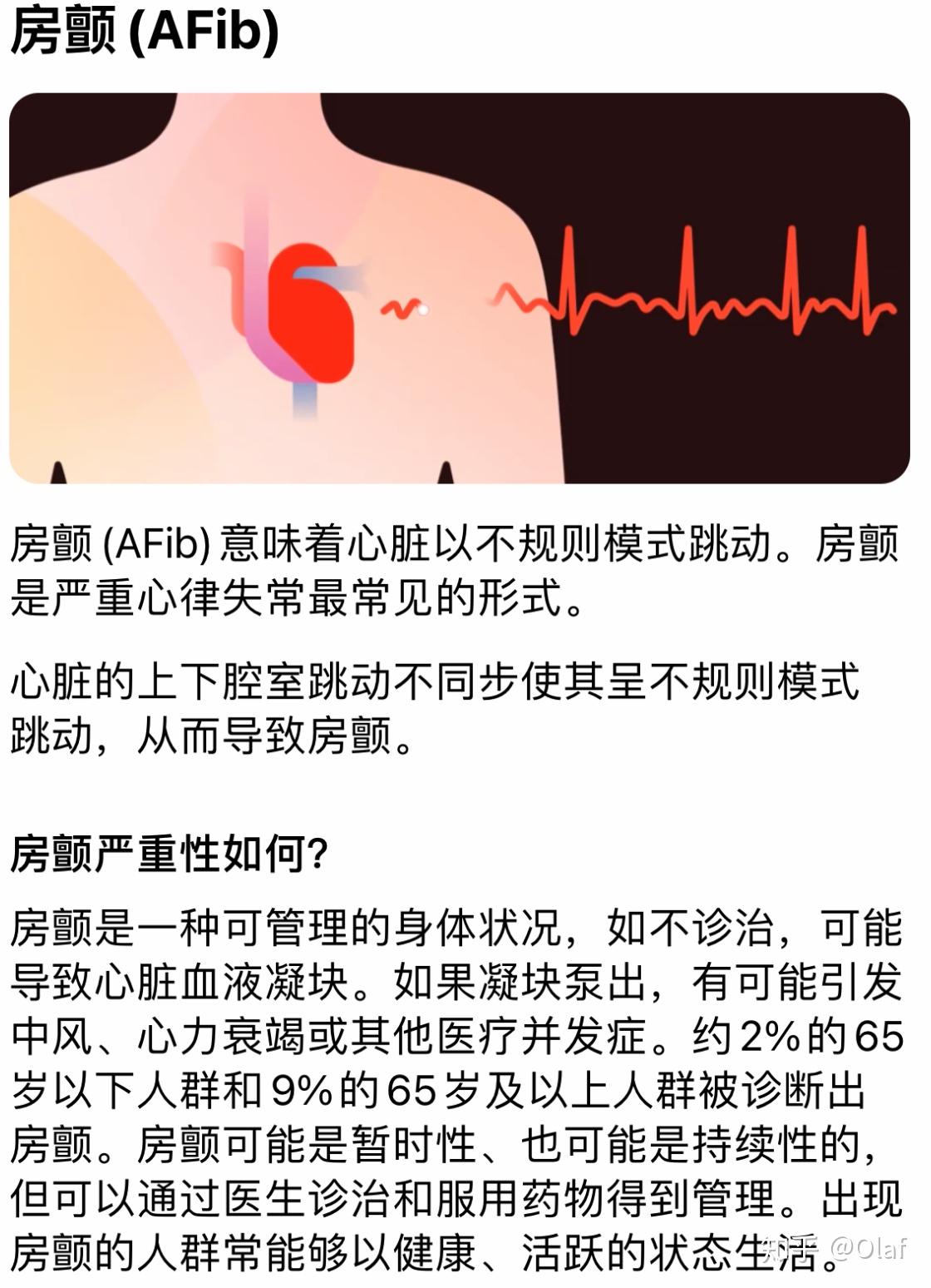 2022年applewatch心电图ecg功能介绍和激活指南看这一篇了解ecg的所有