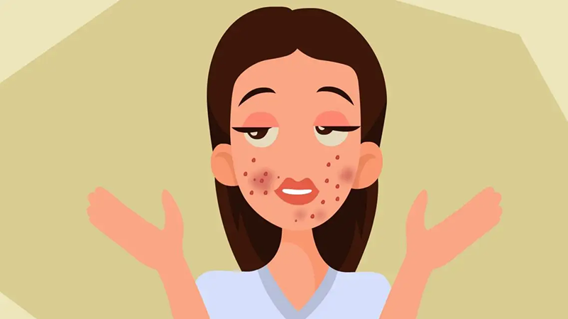 频繁用药膏会导致激素脸温馨提示这2个副作用很多人都不知道