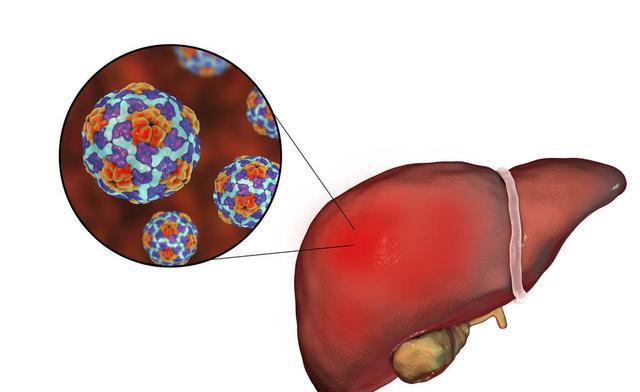 肝功能異常到底會引起哪些後果,這些需要了解,治療還需治根 - 知乎