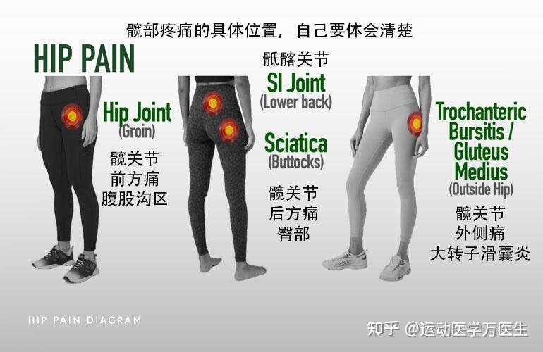 人体髋关节疼痛位置图图片