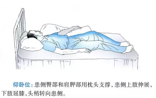 脑梗塞中风患者应该怎么睡比较好