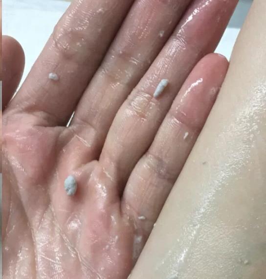 1,去角质:改变粗糙脸,祛黑头