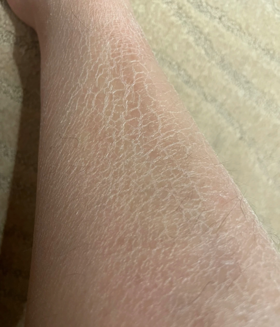 【顶流男士身体乳推荐】夏季皮肤粗糙暗沉,干燥起皮,鸡皮严重怎么办?