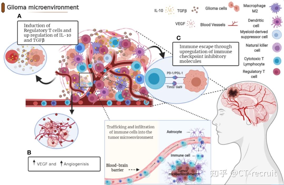 脑胶质瘤治疗效果差的时代即将过去，分子靶向、免疫治疗即将突破 知乎