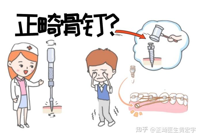 关于打支抗钉痛感