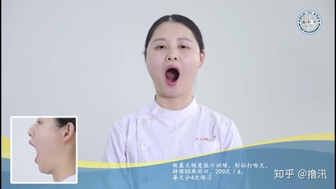 做最大幅度张口训练,形似打哈欠,持续5s再闭口.