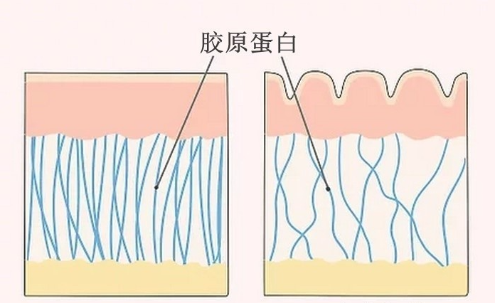 胶原蛋白保护肌肤不受外界压力的重要性 - 知乎