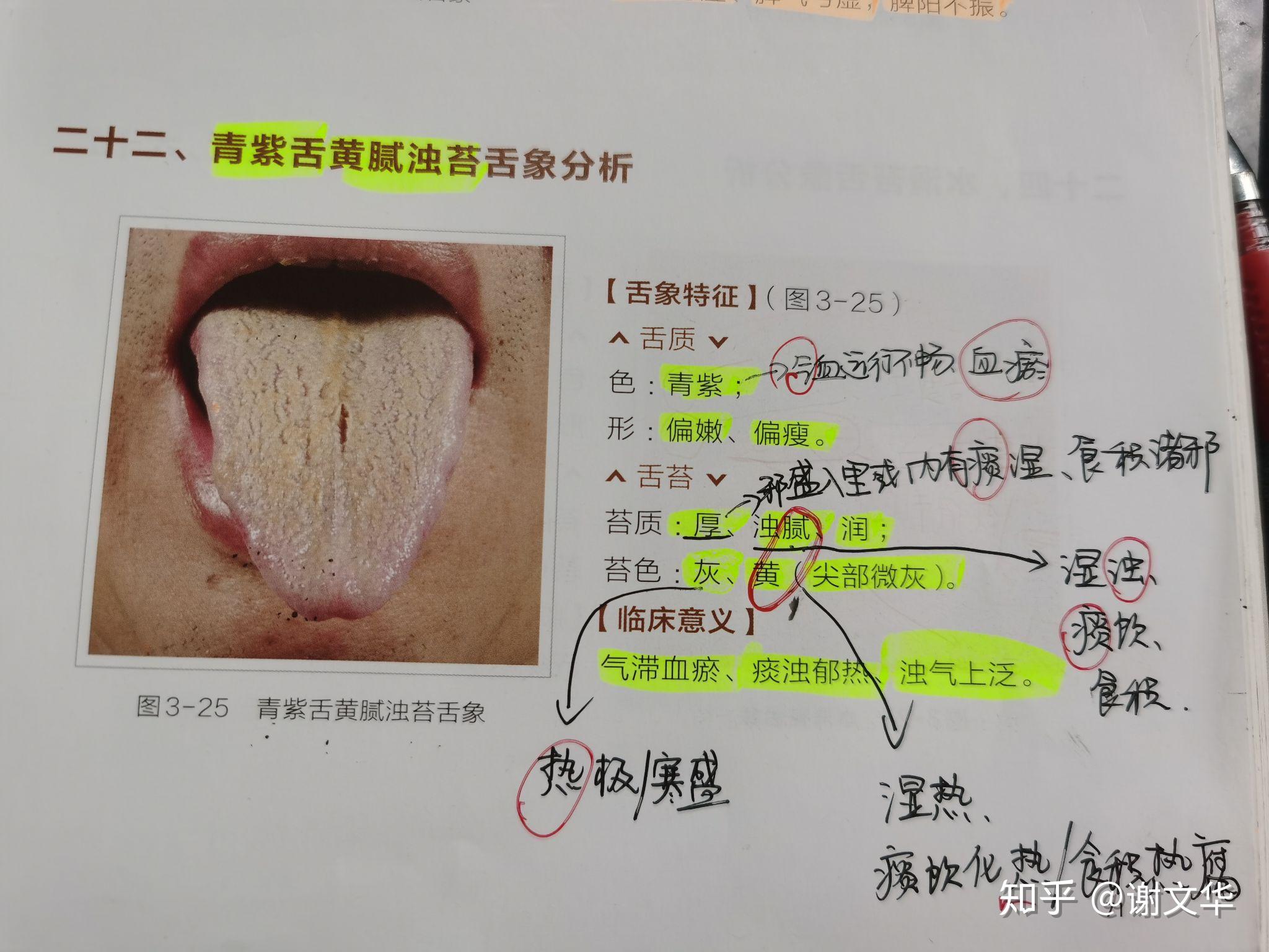 青紫舌黄腻浊苔舌象分析