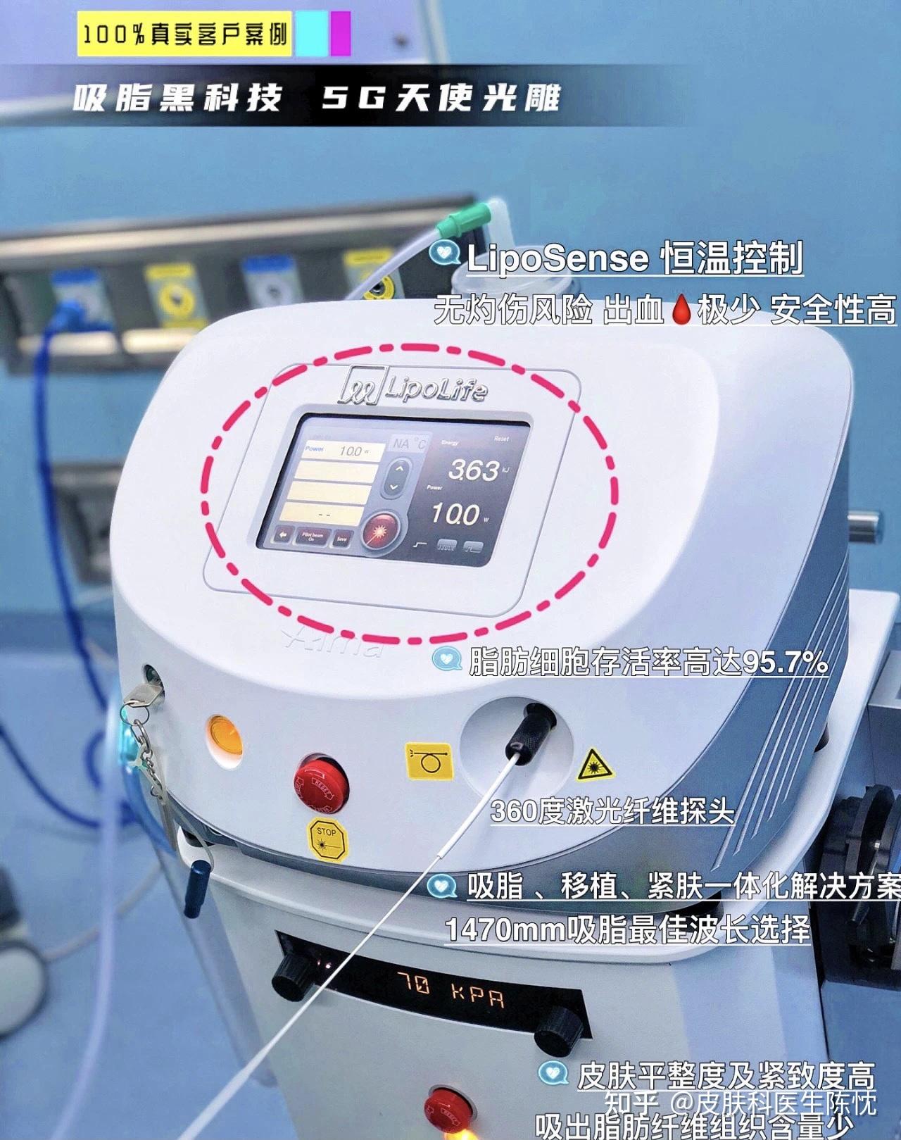 激光加热温度可达5000 v2-d0638b70cb707820259a3e12a0d0ad4a_r.jpg