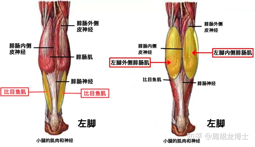 诺,我们小腿后群的肌肉主要由三头肌构成,即腓肠肌和比目鱼肌