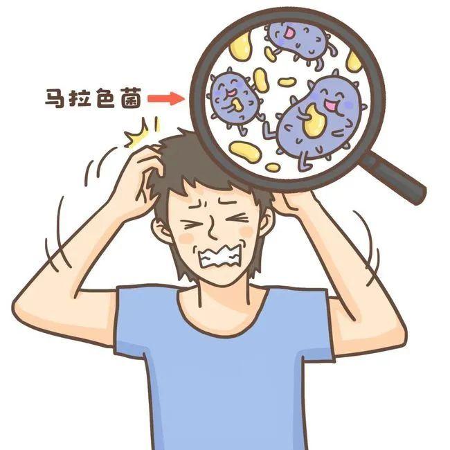 为什么头皮瘙痒,有头屑?