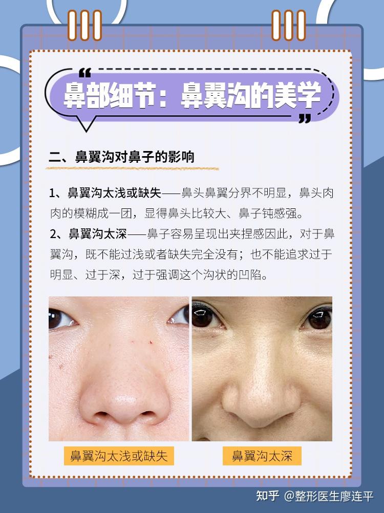 二,鼻翼沟对鼻子的影响