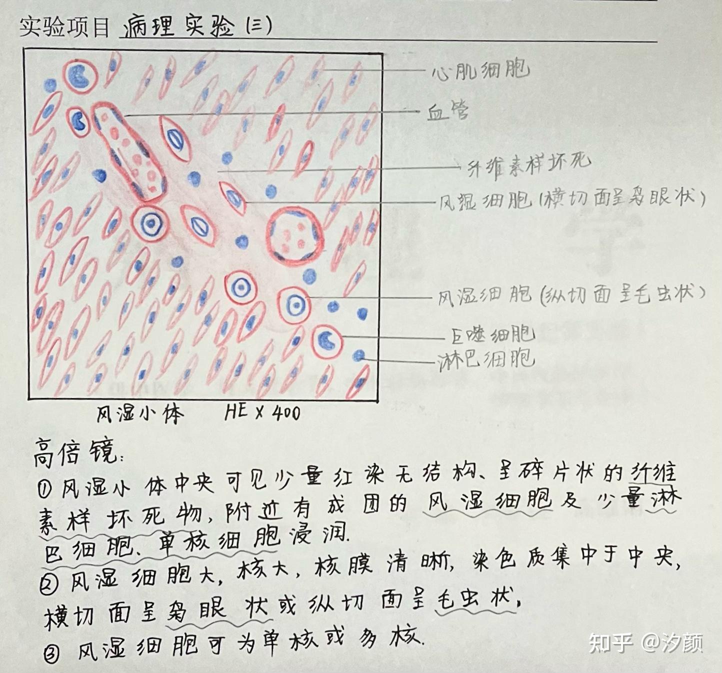 槟榔肝切片绘图图片