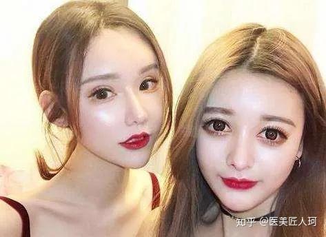 整形脸和高级脸差距全在这四个点