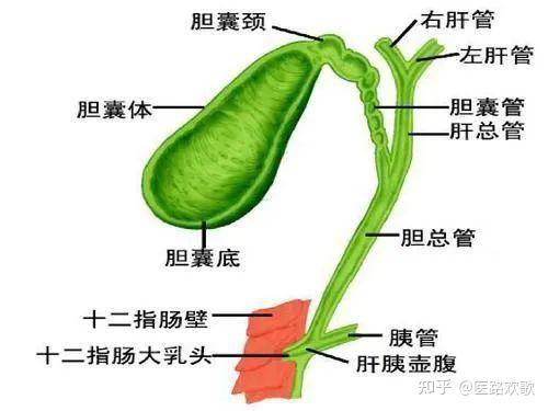 胆石症 - 知乎