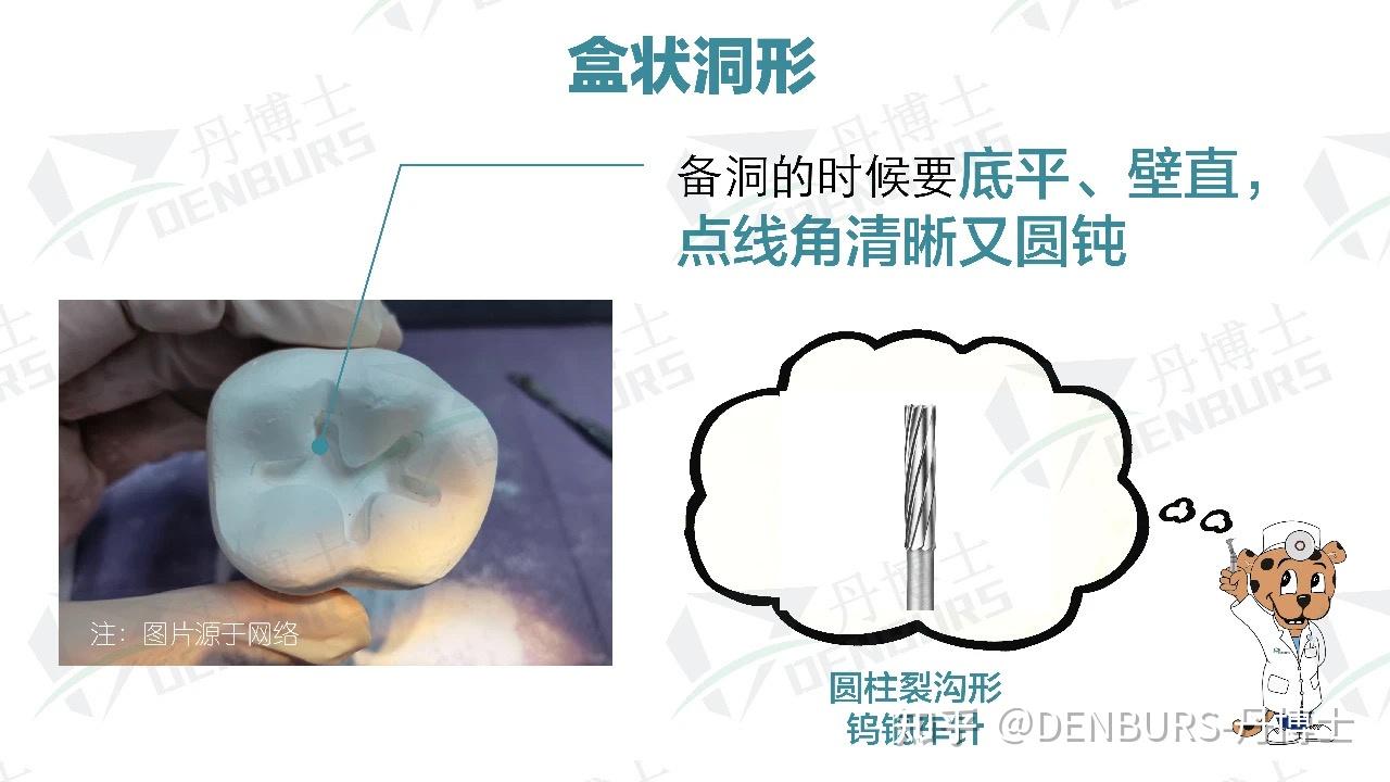 窝洞到底怎么预备?你了解吗?(上) - 知乎
