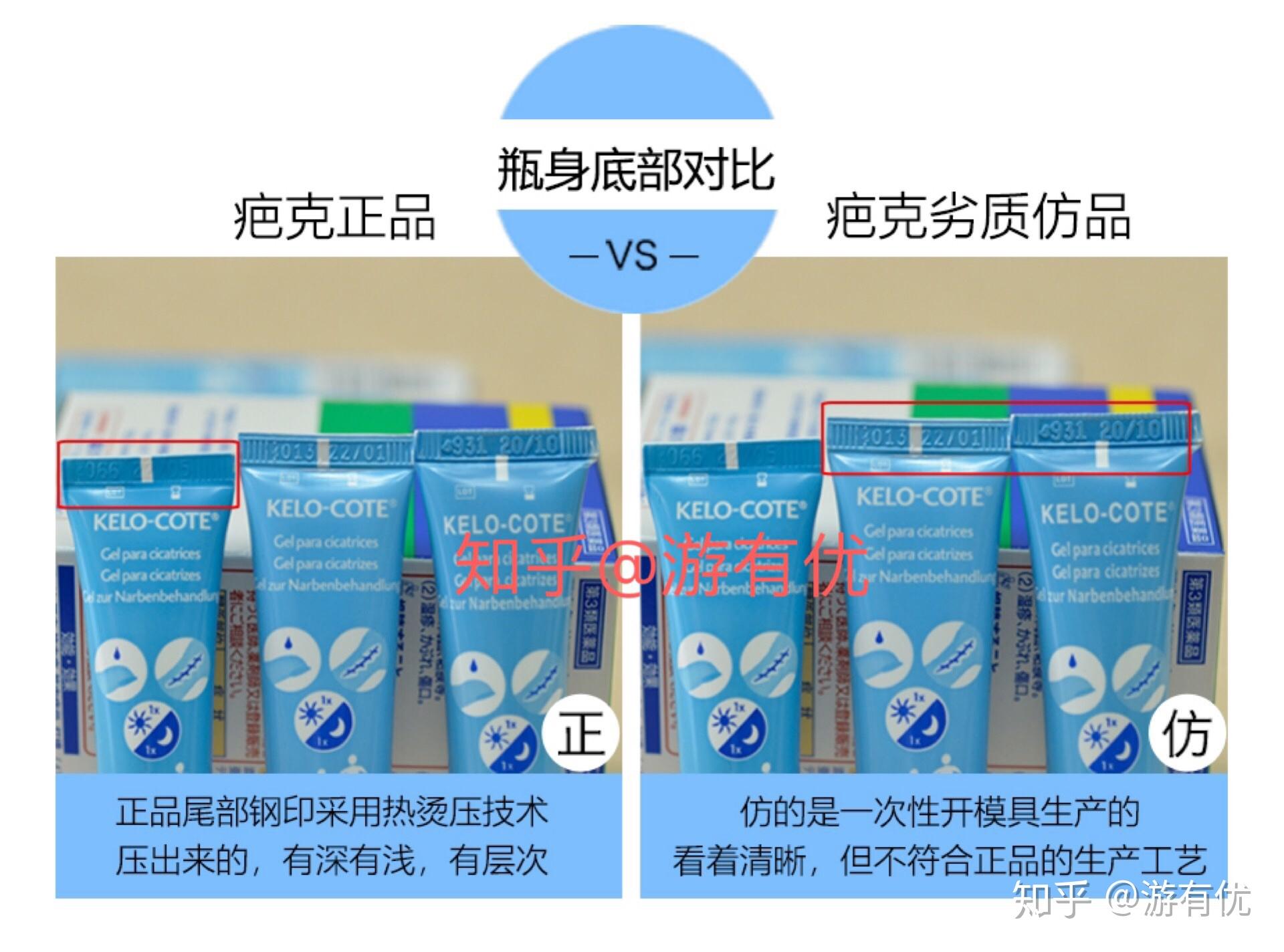 疤克真假辨别真假对比版本区别功效使用方法不同疤痕用什么祛疤组合