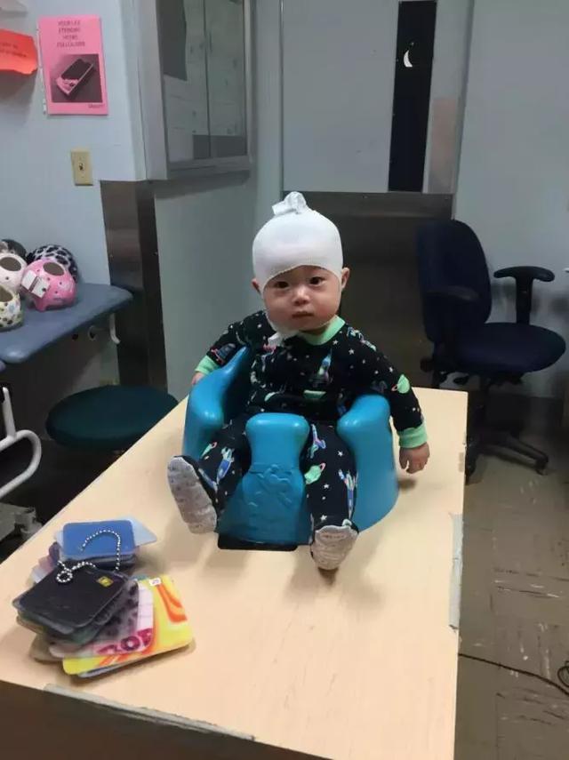 儿童头型矫正医院图片