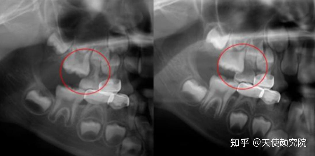 郑秀妍这段太蛊了吧!芒果台怎么能删了不播??!(郑秀妍签约英皇)