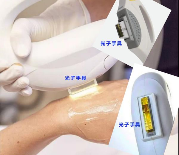 深刻认识强脉冲光(二):强脉冲光的技术进步 - 知乎