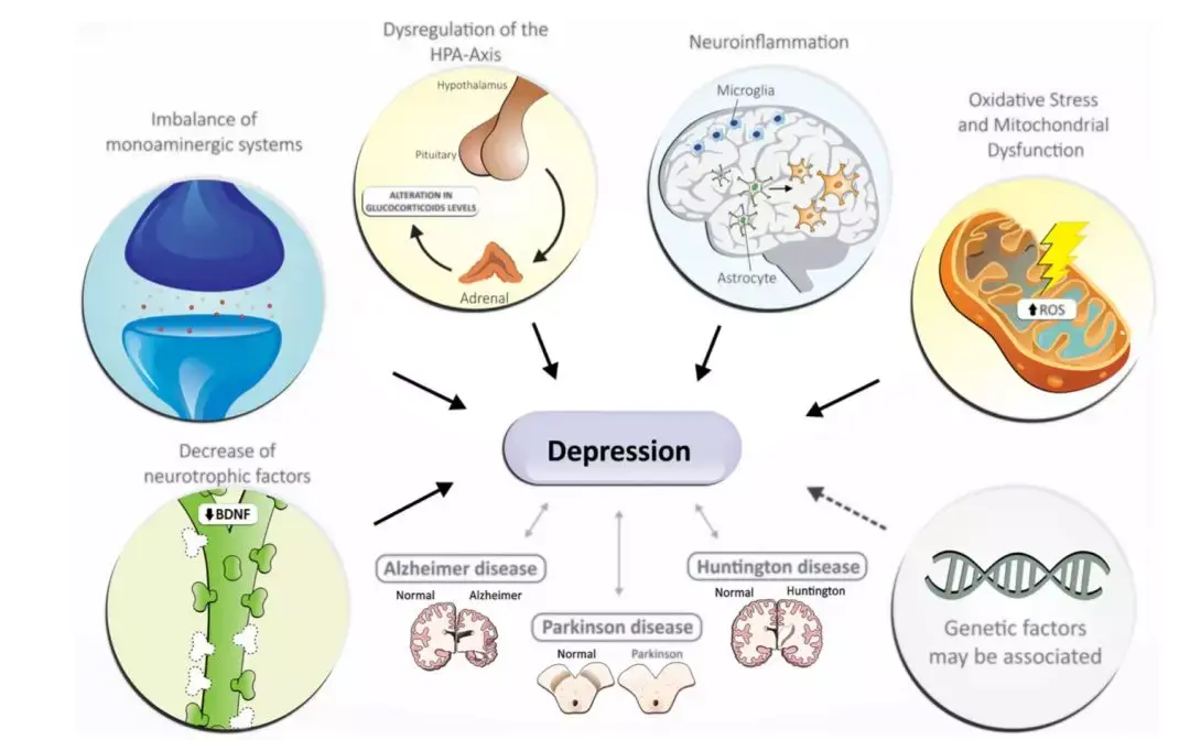 005期brainnews抑郁症研究简报