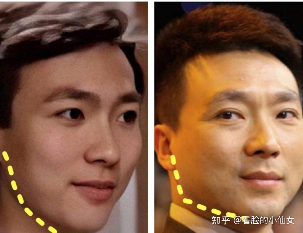 救命!难道成年人都逃不过发腮吗?发腮了应该怎么办?! - 知乎